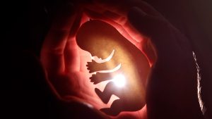 Respect Life (Donor) | 12729
